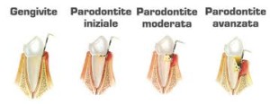 parodontologia 2